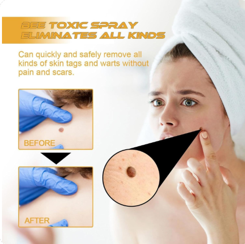Tag recede Bees Treatment Spray